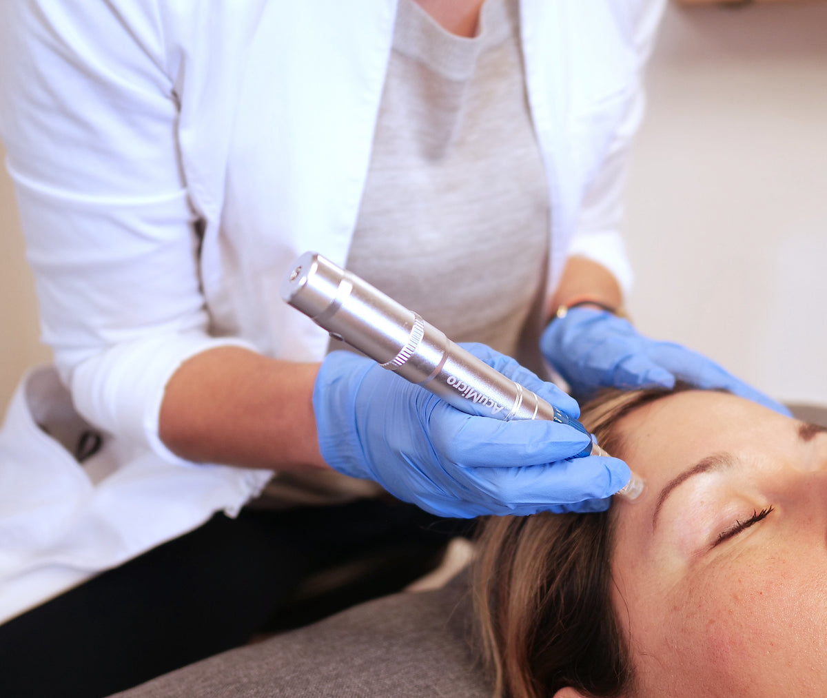 An AcuMicro microneedling pen being used in a professional treatment setting