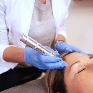 An example of an Acupuncturist Microneedling on a patient