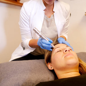 In San Diego, CA! "HANDS-ON & IN-PERSON : MICRONEEDLING FOR ACUPUNCTURISTS"